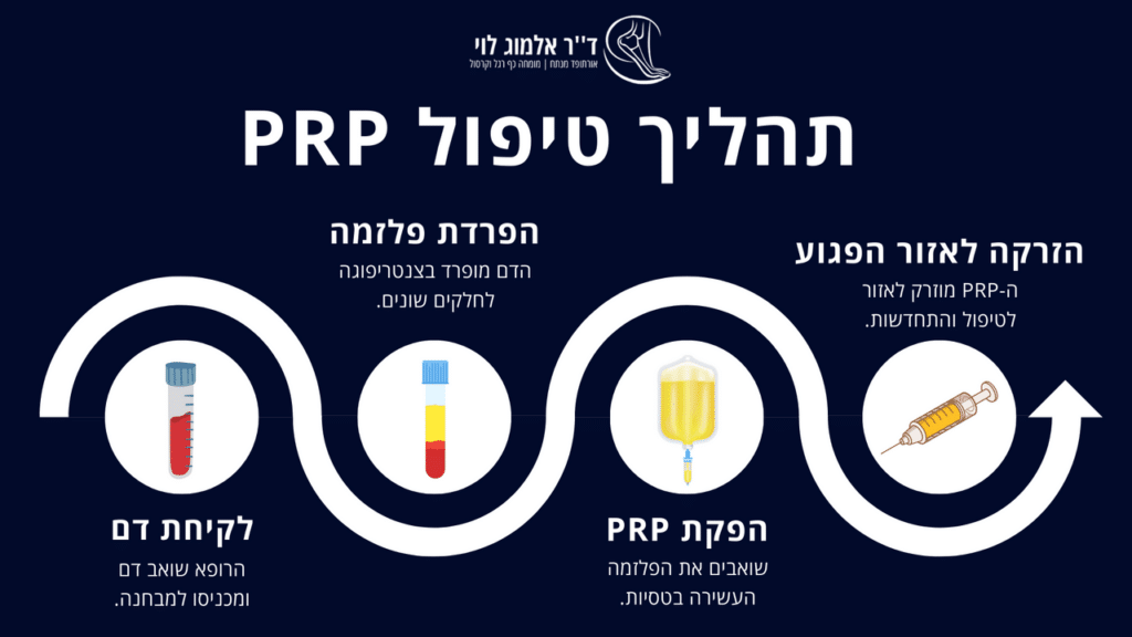 תהליך טיפול PRP