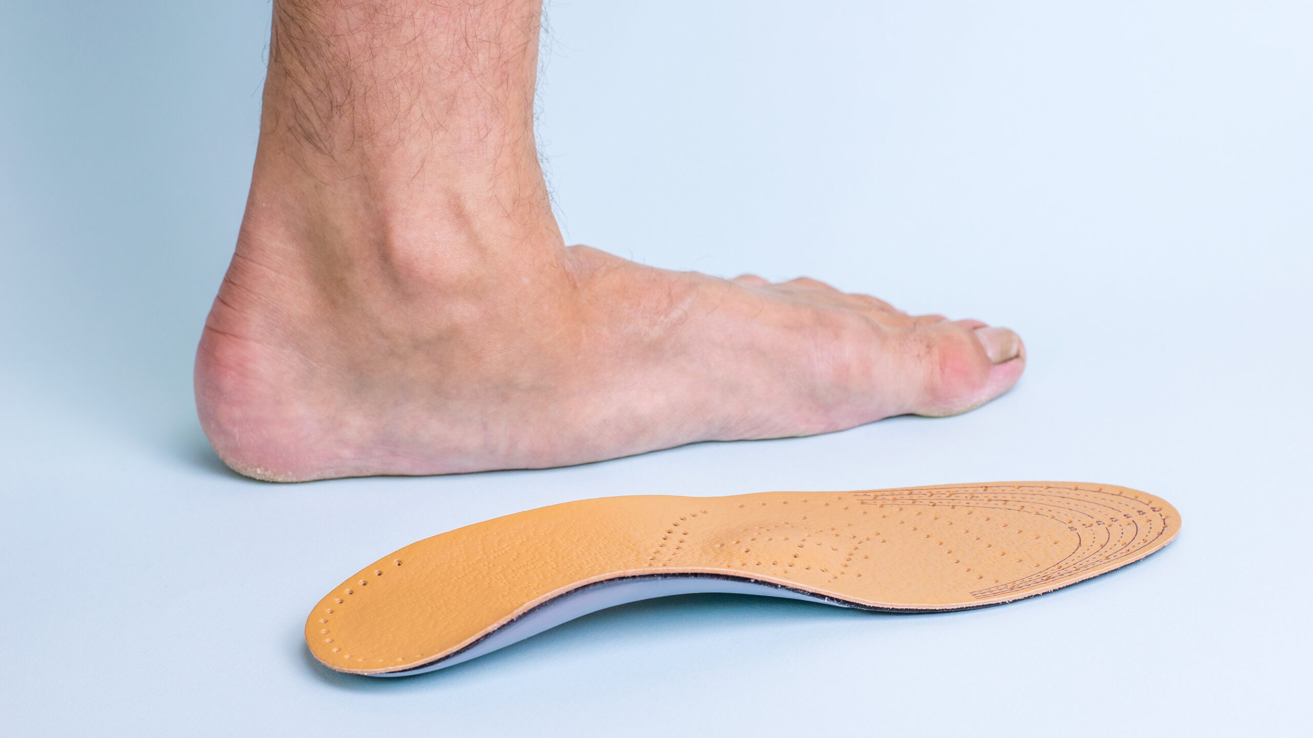תיקון כף רגל שטוחה (FLAT FOOT)