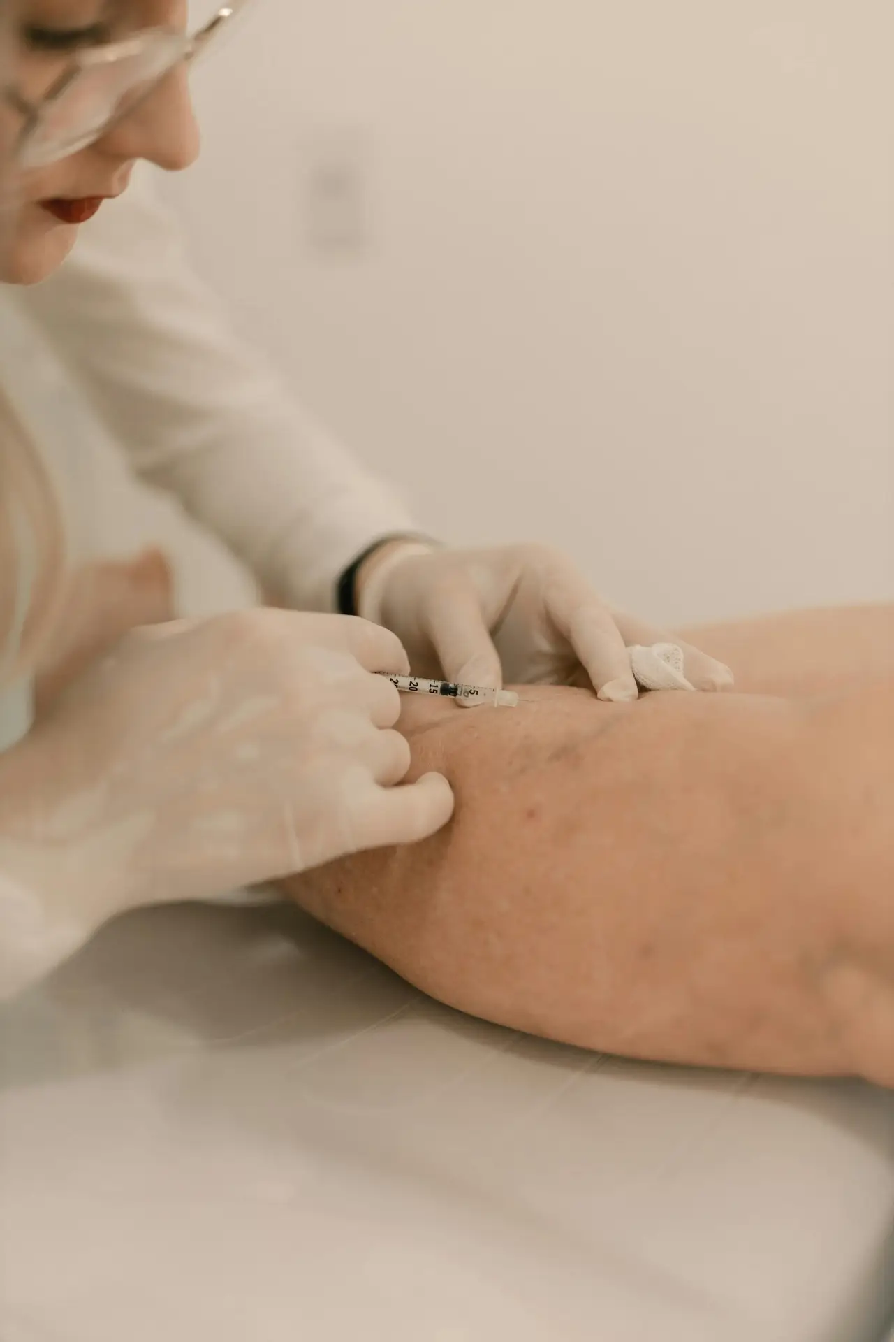 טיפול PRP בשילוב חומצה היאלורונית – היתרונות והסינרגיה של הטיפול המשולב
